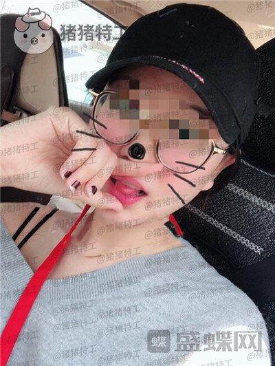 上海九院张盈帆下颌角整形案例价格分享,觉得自己现在超美的充满自信!