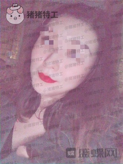 上海九院张盈帆下颌角整形案例价格分享,觉得自己现在超美的充满自信!