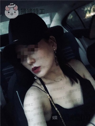 上海九院张盈帆下颌角整形案例价格分享,觉得自己现在超美的充满自信!