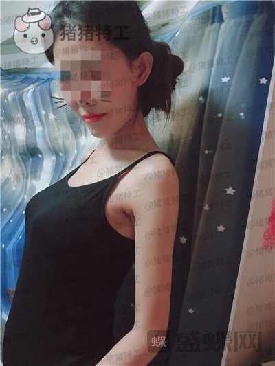 北京美莱董岩岩隆胸案例价格分享,飞机场竟然也能做成这个果!