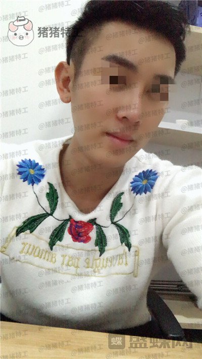 深圳艾妍徐荣阳隆鼻案例价格分享,以为是逆天换头术竟然只是做了个鼻子?