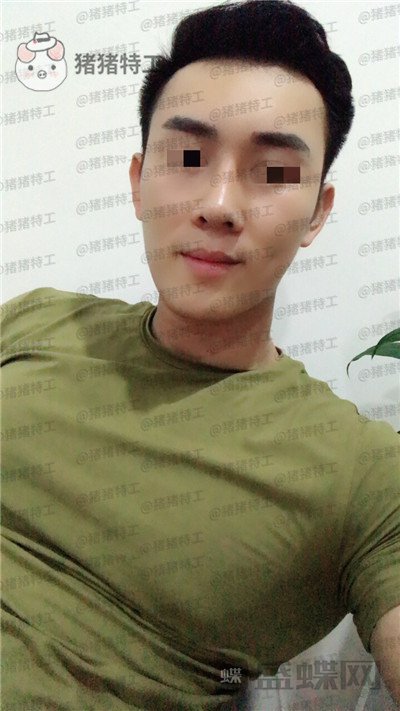 深圳艾妍徐荣阳隆鼻案例价格分享,以为是逆天换头术竟然只是做了个鼻子?
