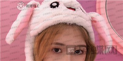 广东画美牟北平双眼皮案例价格分享,想要自然双眼皮的小仙女注意啦!