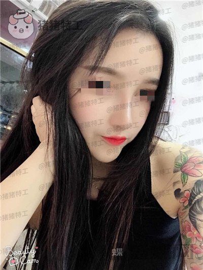 重庆华美蒋琳隆鼻案例价格分享,仙女隆鼻之后是一种是什么体验?