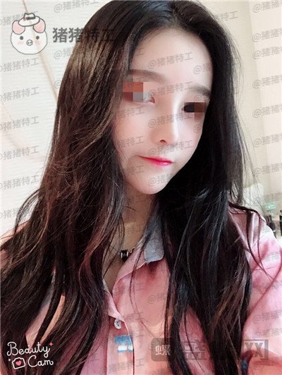 重庆华美蒋琳隆鼻案例价格分享,仙女隆鼻之后是一种是什么体验?