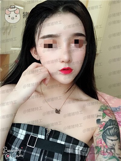 重庆华美蒋琳隆鼻案例价格分享,仙女隆鼻之后是一种是什么体验?