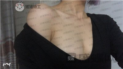 杭州艺星万连壮隆胸案例价格分享,看到现在的自己晚上做梦都能笑出声来!
