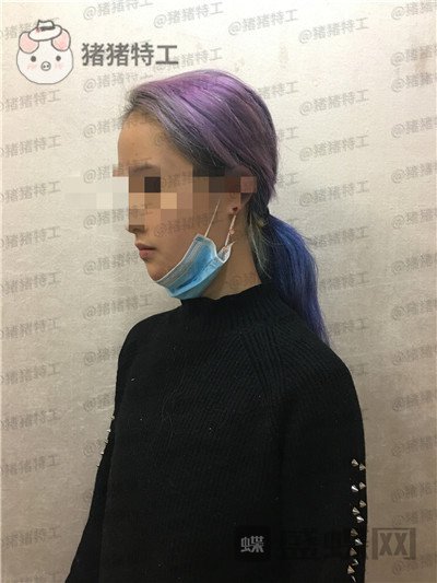 杭州艺星万连壮隆胸案例价格分享,看到现在的自己晚上做梦都能笑出声来!