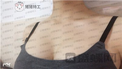 杭州艺星万连壮隆胸案例价格分享,看到现在的自己晚上做梦都能笑出声来!