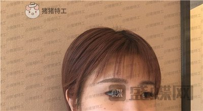 杭州艺星杨连华眼部手术案例价格分享,这个眼睛真的是可爱萌占完了!