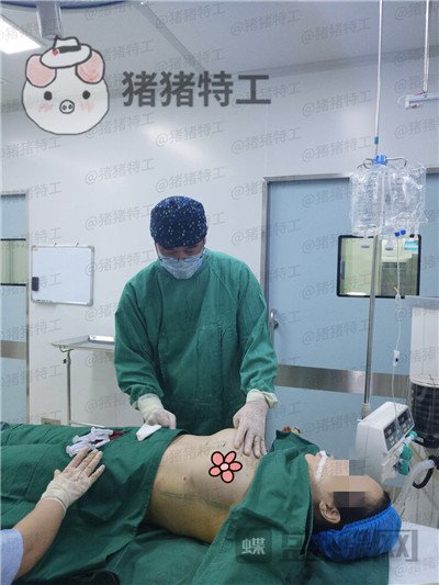 南京美贝尔黄名斗隆胸案例价格分享,穿上伴娘服的我被自己美到了!