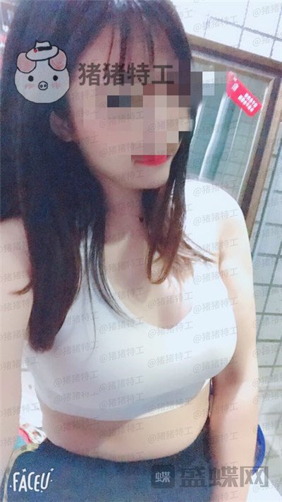 南京美贝尔黄名斗隆胸案例价格分享,穿上伴娘服的我被自己美到了!