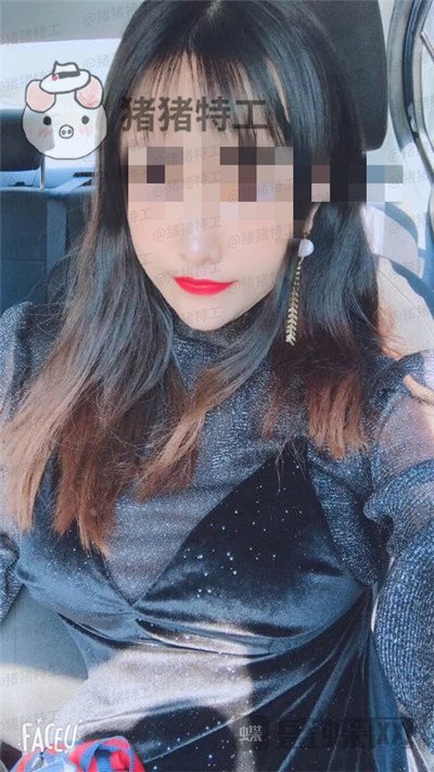 南京美贝尔黄名斗隆胸案例价格分享,穿上伴娘服的我被自己美到了!