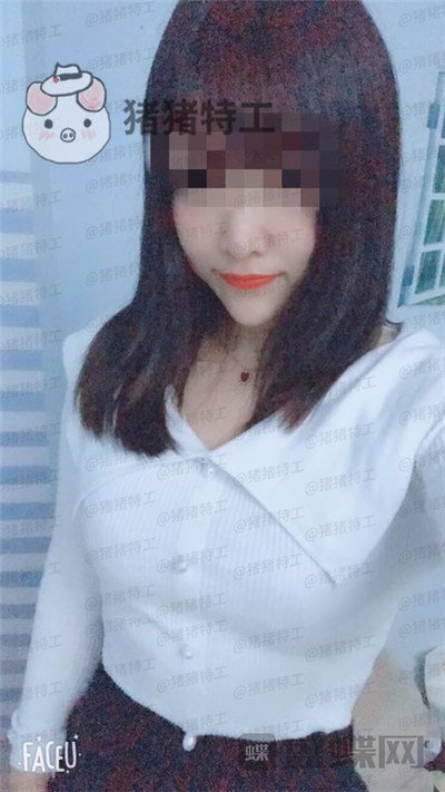南京美贝尔黄名斗隆胸案例价格分享,穿上伴娘服的我被自己美到了!
