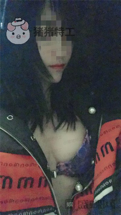 南京美贝尔黄名斗隆胸案例价格分享,穿上伴娘服的我被自己美到了!