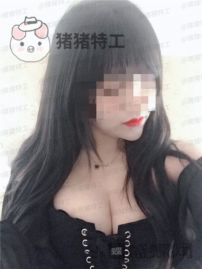 南京美贝尔黄名斗隆胸案例价格分享,穿上伴娘服的我被自己美到了!