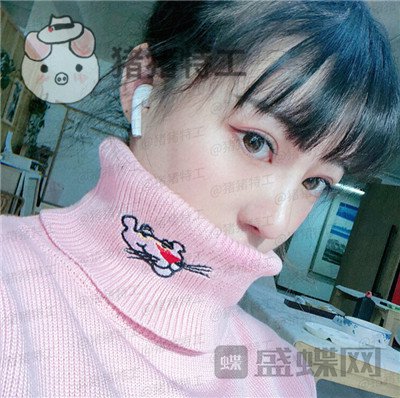 北京悦丽汇姚然鼻部手术案例价格分享,这个果不愧是院长亲自操作!