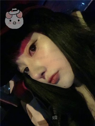 北京悦丽汇姚然鼻部手术案例价格分享,这个果不愧是院长亲自操作!