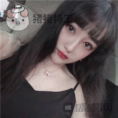 北京悦丽汇姚然鼻部手术案例价格分享,这个果不愧是院长亲自操作!
