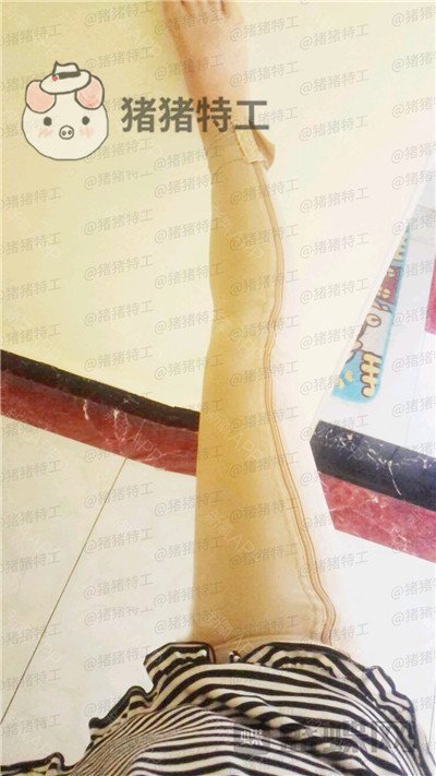 成都西区医院毛健清吸脂案例价格分享,果立竿见影筷子腿竟然这么容易?