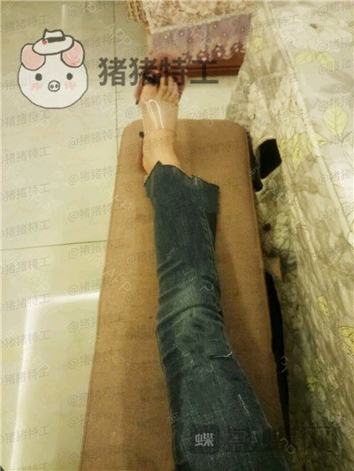 成都西区医院毛健清吸脂案例价格分享,果立竿见影筷子腿竟然这么容易?
