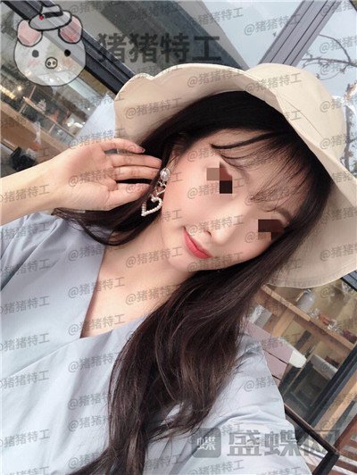 上海九院李茂群隆鼻案例价格分享,垫了鼻子法令纹竟然神奇的消失了!