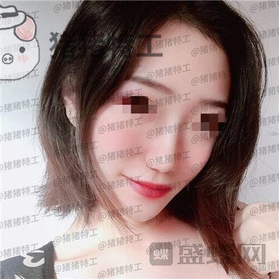 武汉华美马行鼻部手术案例价格分享,优惠的价格竟然可以做的这么完美!