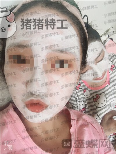 四川友谊张立天下颌角磨骨案例价格分享,脸小了一倍这改变太惊人了!