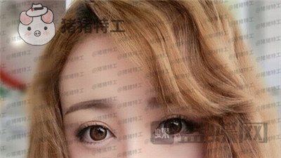 深圳博爱曙光白云双眼皮案例价格分享,这双眼睛具备了好看双眼皮的全部优点。