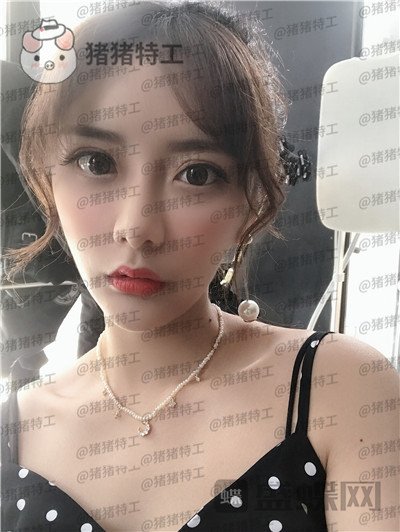 杭州伊琳毛琪面部填充案例价格分享,这个改变我说年轻十几岁不夸张吧!