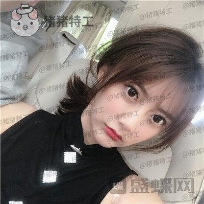 杭州伊琳毛琪面部填充案例价格分享,这个改变我说年轻十几岁不夸张吧!