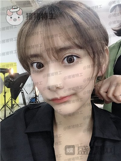 杭州伊琳毛琪面部填充案例价格分享,这个改变我说年轻十几岁不夸张吧!