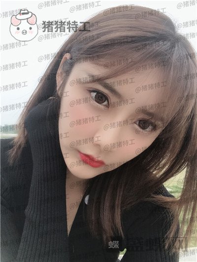 杭州伊琳毛琪面部填充案例价格分享,这个改变我说年轻十几岁不夸张吧!