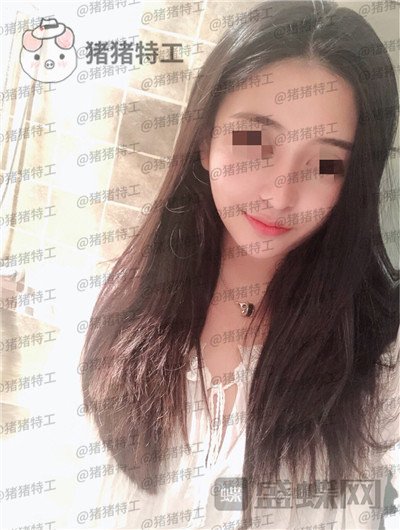 重庆木槿张平隆鼻案例价格分享,做完我都觉得自己太可爱了~