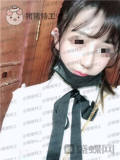重庆木槿张平隆鼻案例价格分享,做完我都觉得自己太可爱了~