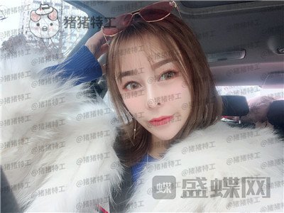 重庆铂生杜亚旭隆鼻案例价格分享,路人变女神一个鼻子就够了?