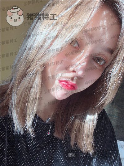 重庆铂生杜亚旭隆鼻案例价格分享,路人变女神一个鼻子就够了?