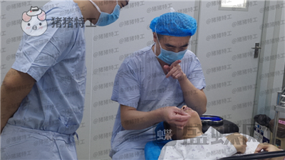 南京美贝尔张永升缩鼻翼案例价格分享,鼻子眼睛好看了相当于换了个头?