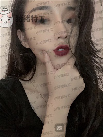 成都西区医院车红昌鼻部手术案例价格分享,拍照不用p的感觉真好~