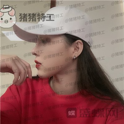 成都西区医院车红昌鼻部手术案例价格分享,拍照不用p的感觉真好~