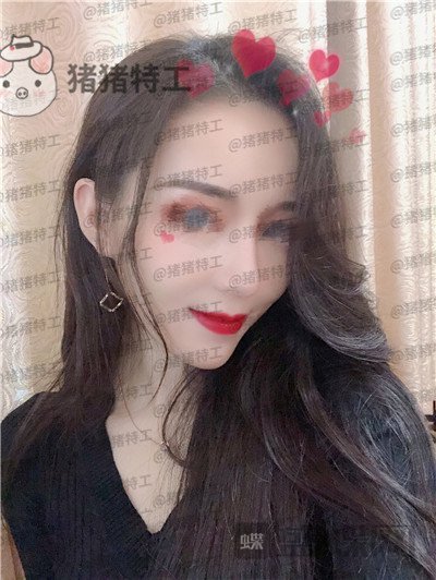 成都西区医院车红昌鼻部手术案例价格分享,拍照不用p的感觉真好~