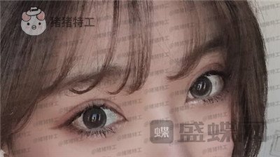 上海九院王维双眼皮修复案例价格分享,之前超假的眼睛现在总算得到了解决~