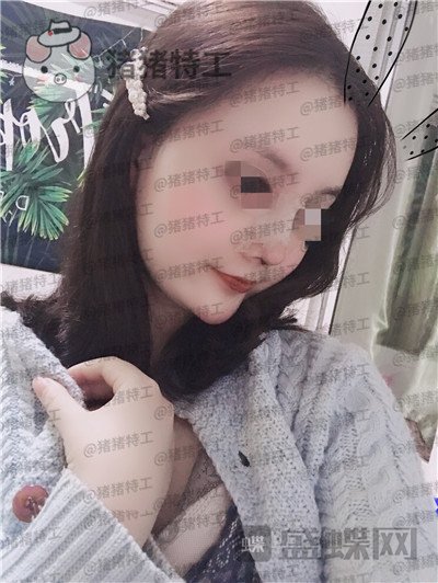 上海百达丽原九院沈国雄隆鼻案例价格分享,九院的医生果然技术不同凡响。