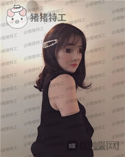 上海百达丽原九院沈国雄隆鼻案例价格分享,九院的医生果然技术不同凡响。
