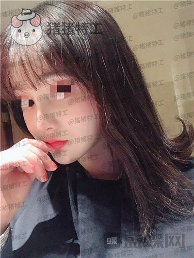 上海百达丽原九院沈国雄隆鼻案例价格分享,九院的医生果然技术不同凡响。