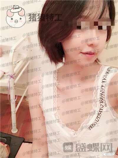 上海九院周珍艳隆胸案例价格分享,做完胸仿佛跟自己的一样~