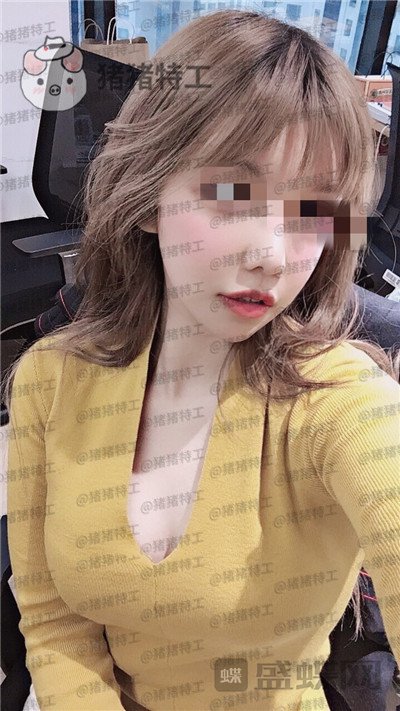 上海九院周珍艳隆胸案例价格分享,做完胸仿佛跟自己的一样~