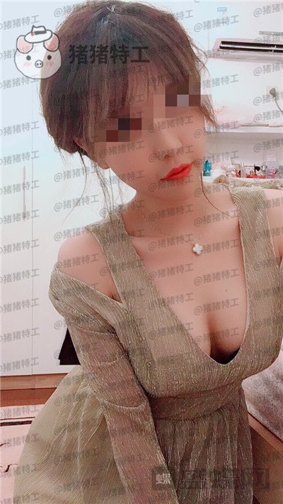 上海九院周珍艳隆胸案例价格分享,做完胸仿佛跟自己的一样~