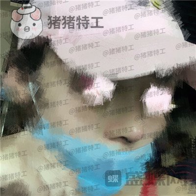北京八大处王欢鼻修复案例价格分享,这么失败的鼻子以为没救了多谢医生妙手回春~