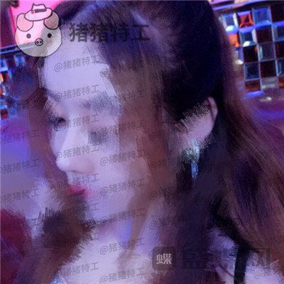 北京八大处王欢鼻修复案例价格分享,这么失败的鼻子以为没救了多谢医生妙手回春~
